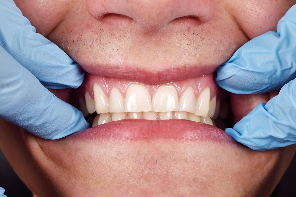 Educație pentru igiena gingiilor