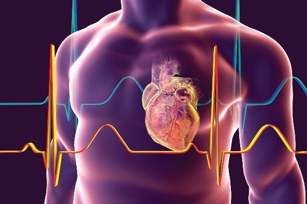 Cardiologie AVA Medical