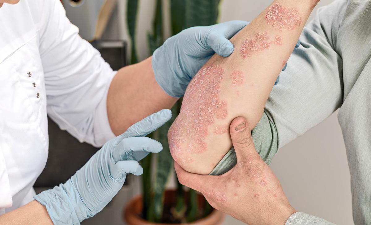Evaluare dermatologică AVA Medical