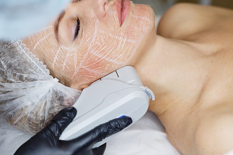 Consultație dermatologică