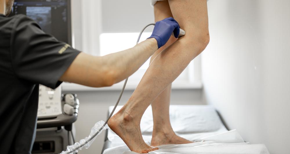 Ecografie Doppler vasculară la nivelul membrelor inferioare