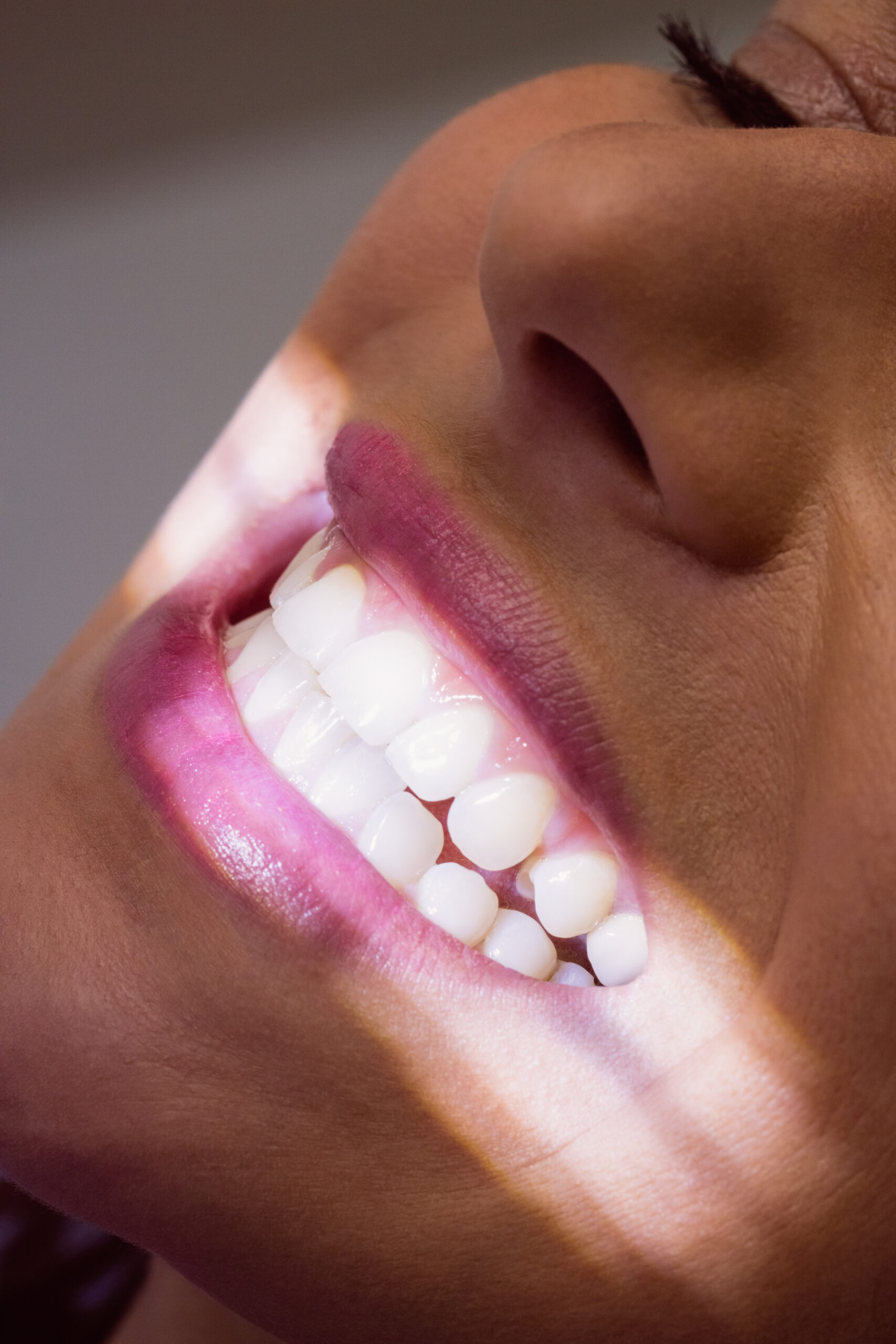 Estetică dentară